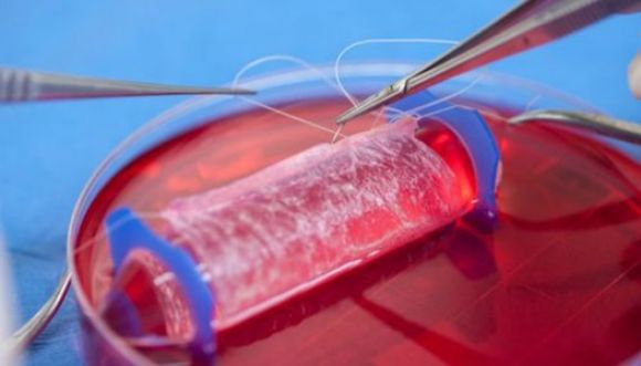 Crean e implantan vaginas artificiales