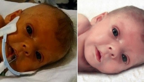 Padre pidió a internautas retocar la foto de su bebé fallecida