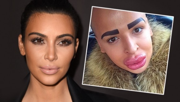 Hombre pagó cirugías para parecerse a Kim Kardashian