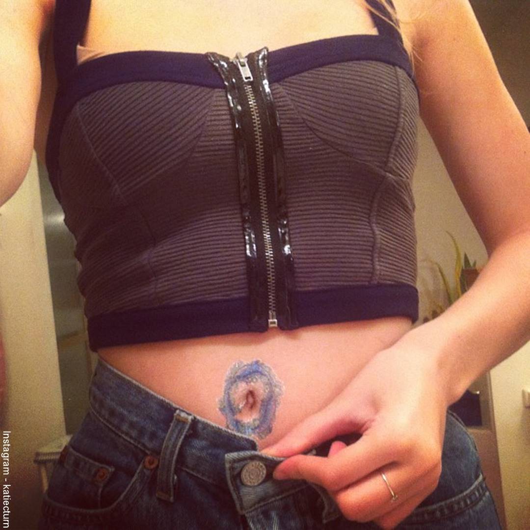 Foto de un tatuaje en el ombligo que parece una infección