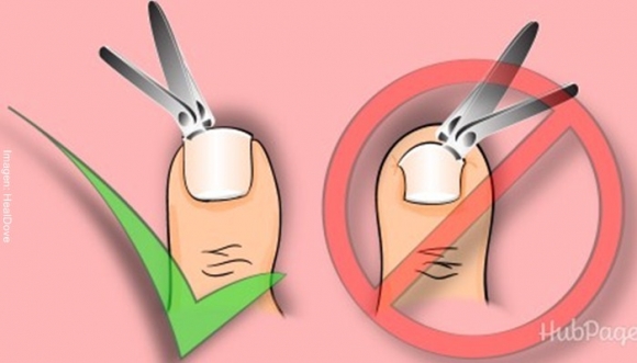 ¿Cómo cortarse BIEN las uñas de los pies?
