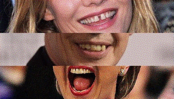 11 famosos con los dientes en desorden