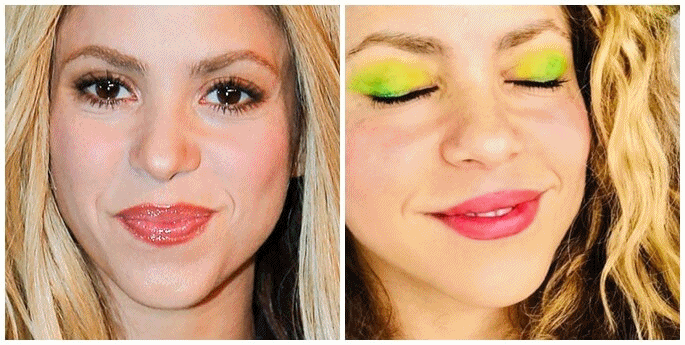 Labios de Shakira, antes y después