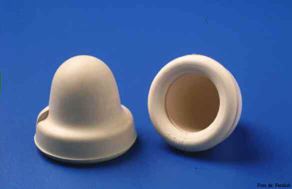 capuchón cervical, métodos anticonceptivos de barrera