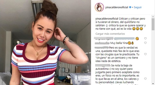 Post polémico de Yina Calderón donde dice que las que critican sus cirugías es por envidia