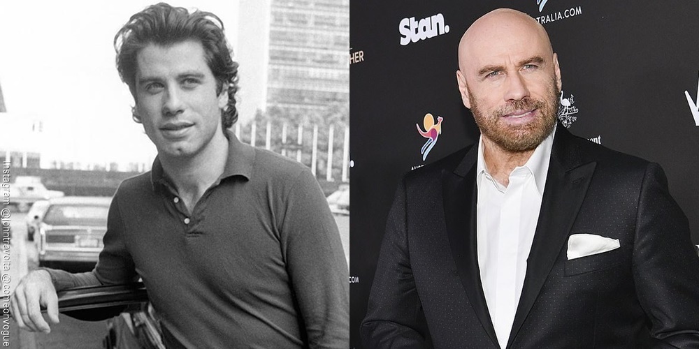 Foto de John Travolta antes y después