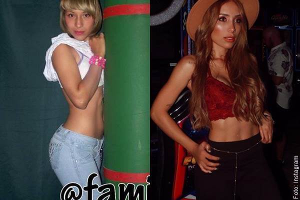 Foto antes y después de Luisa Fernanda
