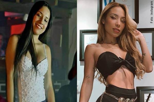 Foto antes y después de Luisa Fernanda 