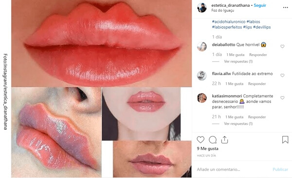 Collage instagram de labios endemoniados rosa