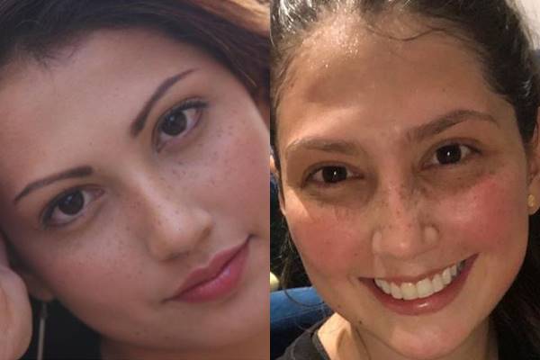 Foto antes y después de la actriz Laura Rodríguez