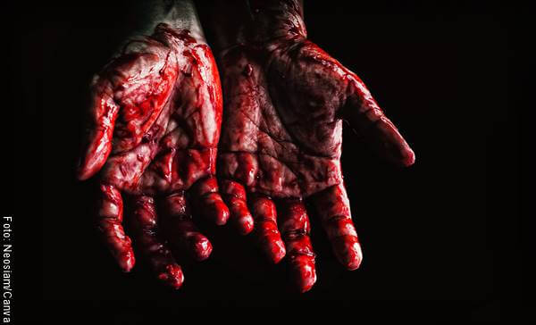 Foto de unas manos ensangrentadas para ejemplificar el significado de soñar con sangre