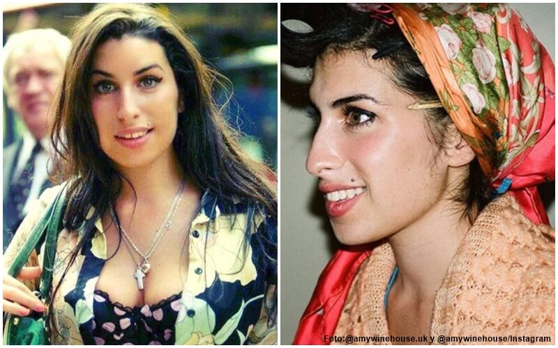Antes y después del diseño de sonrisa de Amy Winehouse
