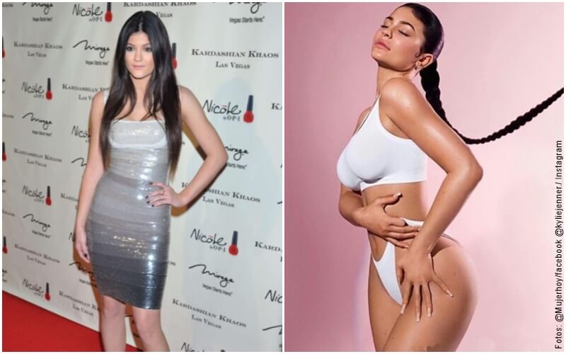 Fotos de Kylie Jenner antes y después de sus cirugías