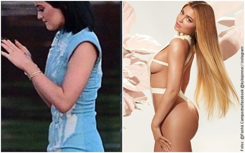 Fotos de Kylie Jenner antes y después de sus cirugías