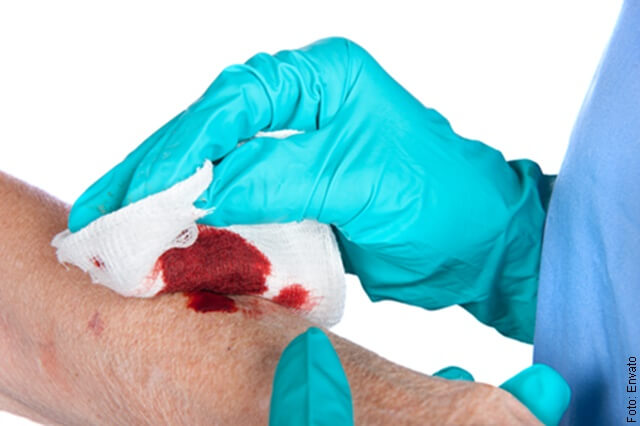 foto de herida con sangre