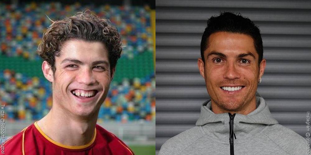 Foto de Cristiano Ronaldo, antes y después