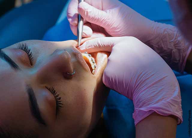 Foto de una mujer recibiendo ortodoncia que revela lo que es soñar con agujas