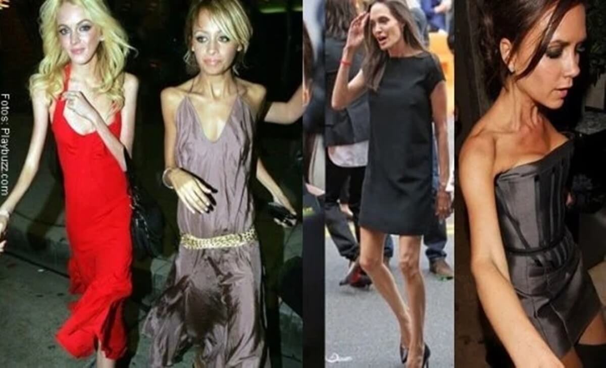 Impresionantes casos de anorexia en Hollywood
