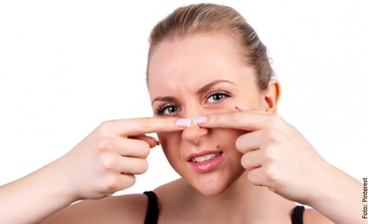 Elimina los puntos negros de tu rostro con vaselina