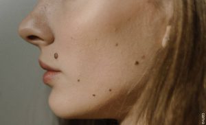 Significado de los lunares en la cara: Revela tu personalidad real