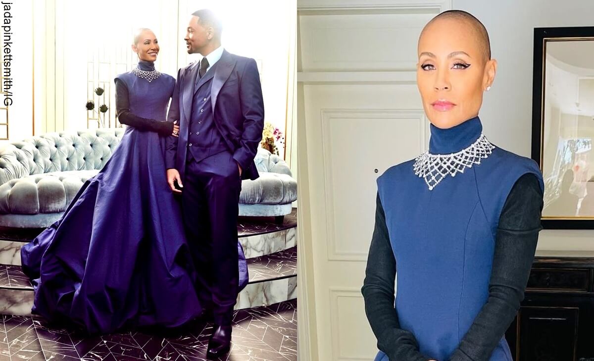 La dura condición de alopecia de Jada Pinkett, esposa de Will Smith