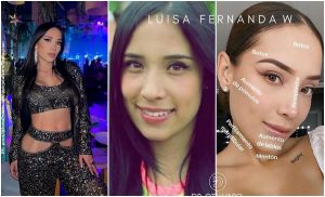 Luisa Fernanda W arremetió contra cirujano que "expuso" sus operaciones
