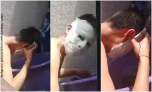 Joven hizo una máscara de yeso de tarea y se le quedó pegada a la cara