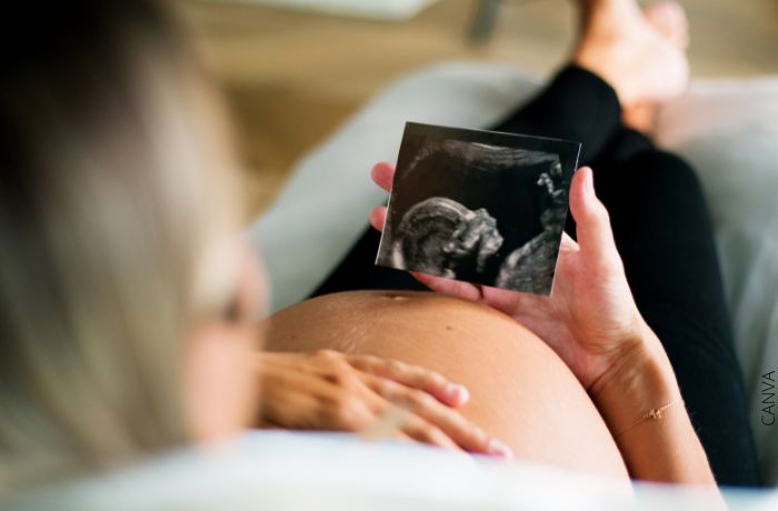 Foto de una mujer embarazada viendo una ecografía