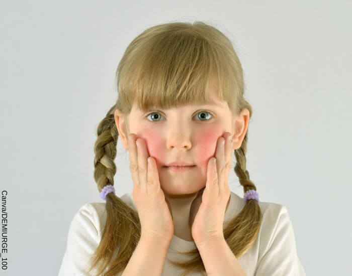 Foto de una niña con las mejillas sonrojadas