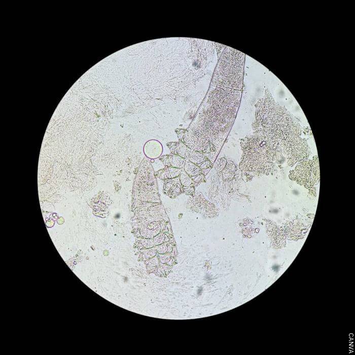 Foto de ácaros en el microscopio