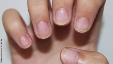 Enfermedades y trastornos de las uñas más comunes