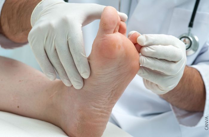Foto de las manos de un doctor revisando el pie de si paciente
