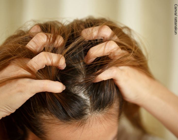 Foto de la cabeza de una mujer mientras se pica el cuero cabelludo con desespero