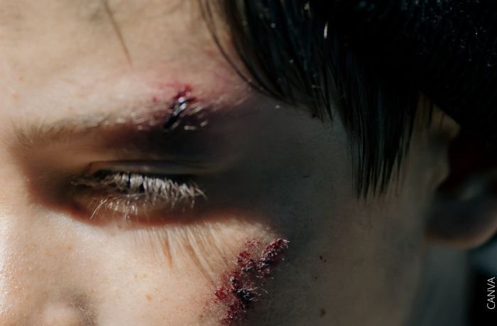 Foto de un hombre con heridas en la cara