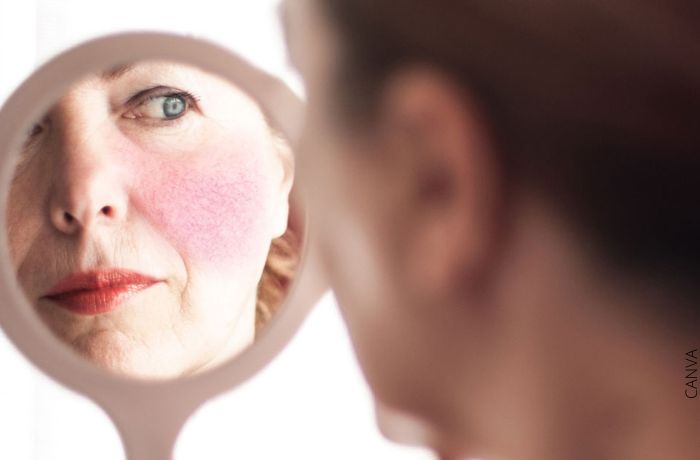 Foto de una mujer mirandose al espejo con el rostro enrojecido para ilustrar ¿Para qué sirve el hielo en la cara? Correrás a probarlo