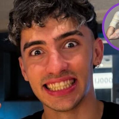 Influencer perdió dos dedos