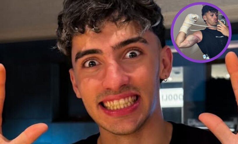 Influencer perdió dos dedos