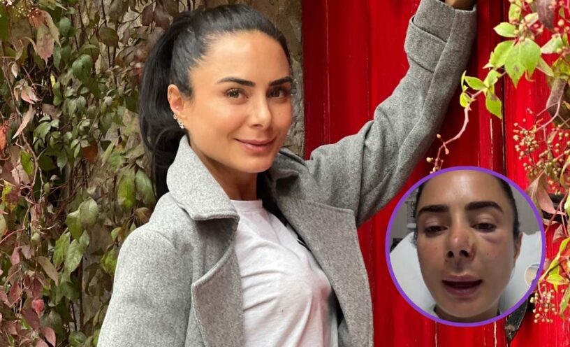 Johanna Fadul sufrió accidente