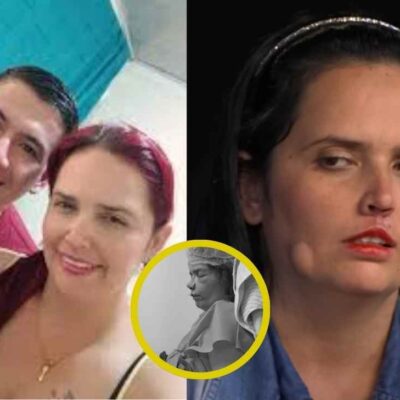 mujer que fue brutalmente atacada a mordiscos por su expareja