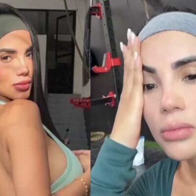 Karina García mostró cómo quedó su rostro tras accidente en el gym