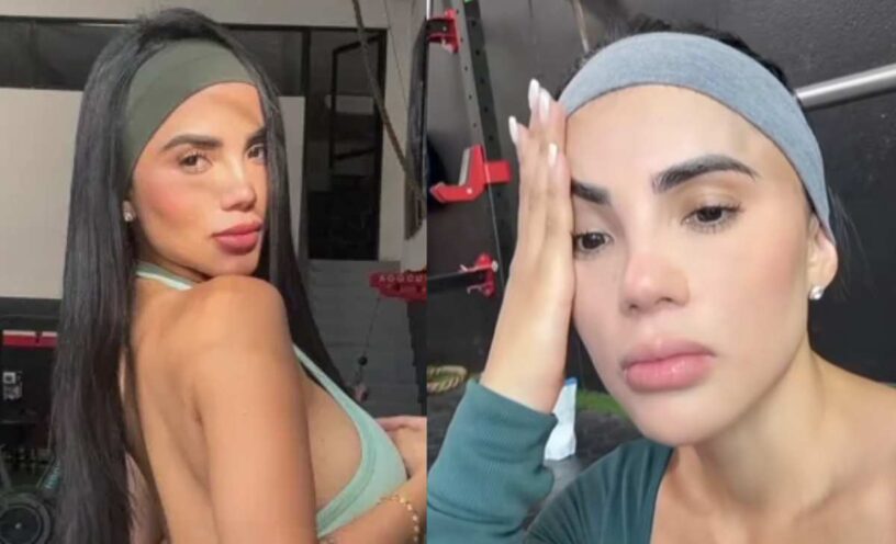 Karina García mostró cómo quedó su rostro tras accidente en el gym
