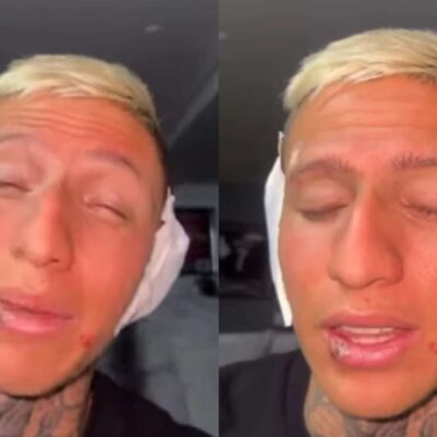 La Liendra reveló la verdad de sus heridas