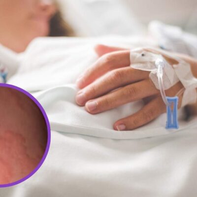 actriz mostró su problema de salud