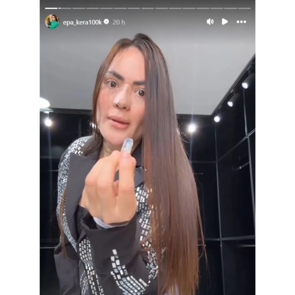 Foto de un pantallazo de historias de Instagram de Epa Colombia mostrando el plástico que le sacaron de la cara