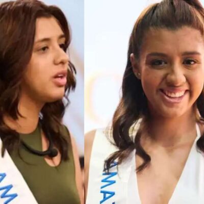 Rebeca Castillo, candidata de Amazonas que renunció a Miss Universe Colombia, se hizo retoque estético