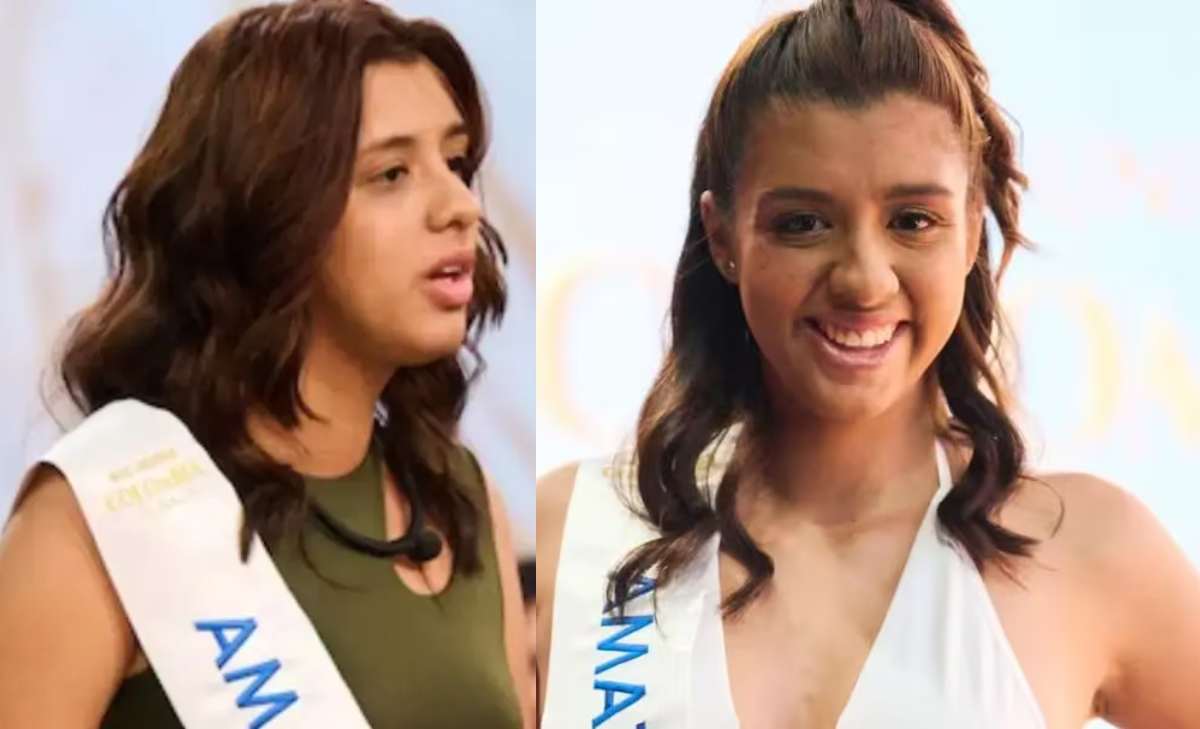 Rebeca Castillo, candidata de Amazonas que renunció a Miss Universe Colombia, se hizo retoque estético