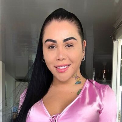 Resultados de las cirugías de Yina Calderón