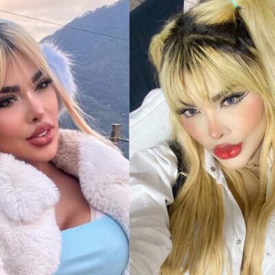 La Barbie colombiana reveló que le hicieron atentado y mostró imágenes