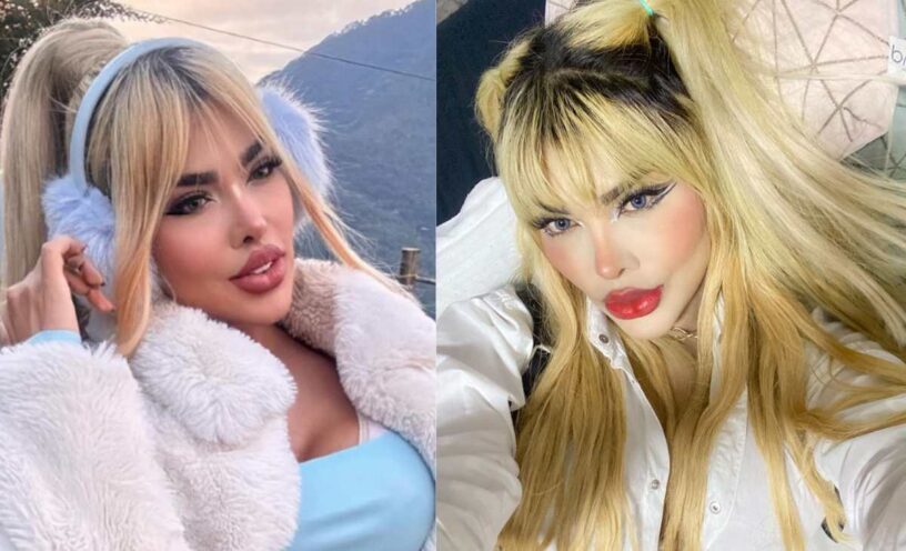 La Barbie colombiana reveló que le hicieron atentado y mostró imágenes