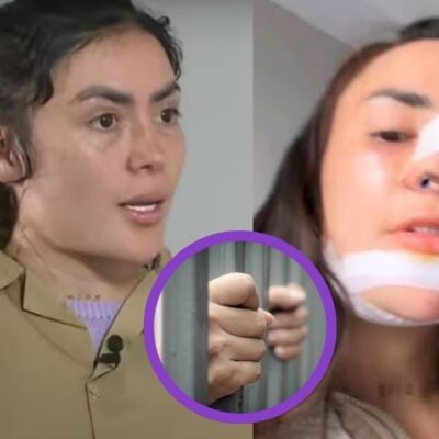 La foto del informe que revela que Epa Colombia se aplicó relleno de labios y glúteos dentro de la cárcel